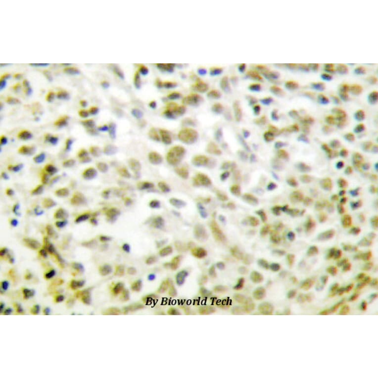 Anti-p53 (T310) Antibody from Bioworld Technology (BS1682) - Antibodies.com