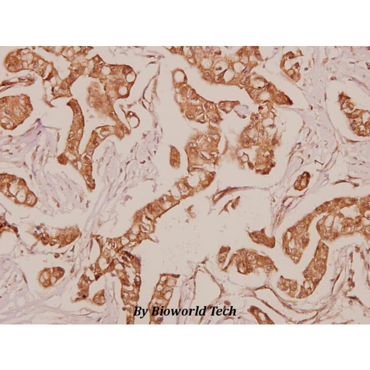 Anti-PDGFR-α (S1057) Antibody from Bioworld Technology (BS1684) - Antibodies.com