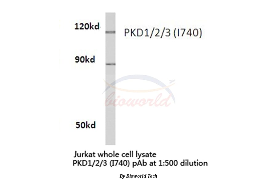 Anti-PKD1/2/3 (I740) Antibody from Bioworld Technology (BS1685) - Antibodies.com