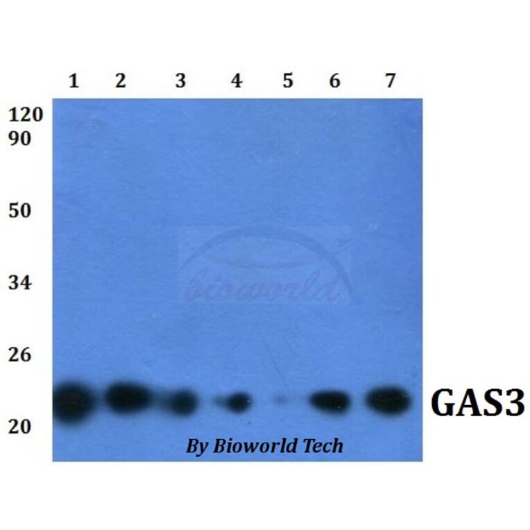 Anti-GAS3 (A142) Antibody from Bioworld Technology (BS1688) - Antibodies.com