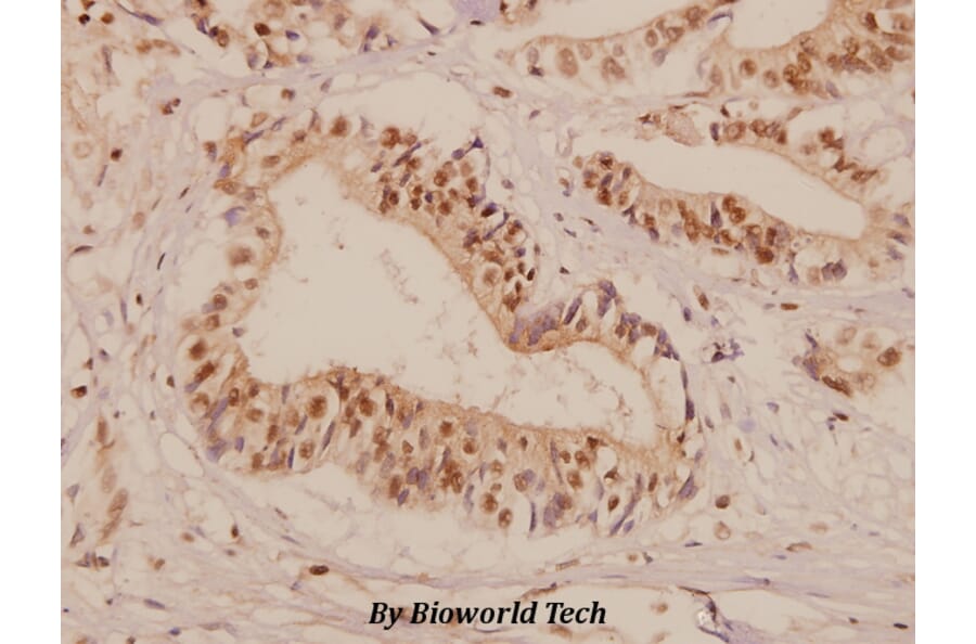 Anti-GAS3 (A142) Antibody from Bioworld Technology (BS1688) - Antibodies.com
