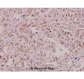 Anti-RPA2 (A17) Antibody from Bioworld Technology (BS1692) - Antibodies.com