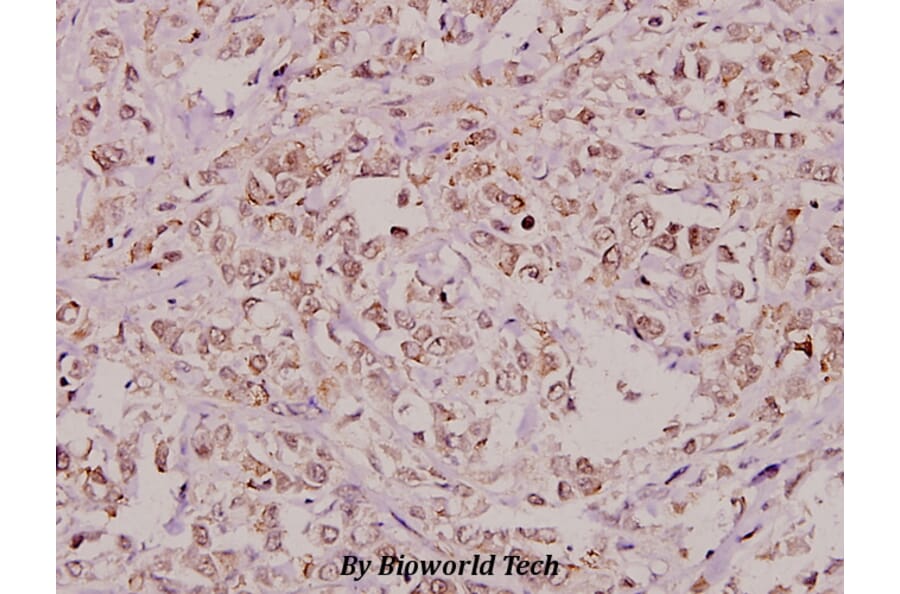 Anti-RPA2 (A17) Antibody from Bioworld Technology (BS1692) - Antibodies.com