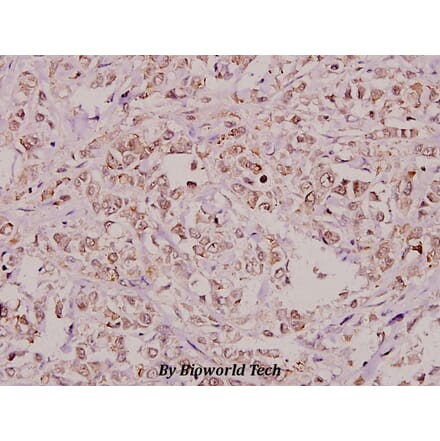 Anti-RPA2 (A17) Antibody from Bioworld Technology (BS1692) - Antibodies.com