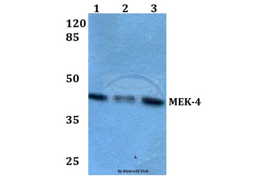 Anti-MEK-4 (Q253) Antibody from Bioworld Technology (BS1693) - Antibodies.com