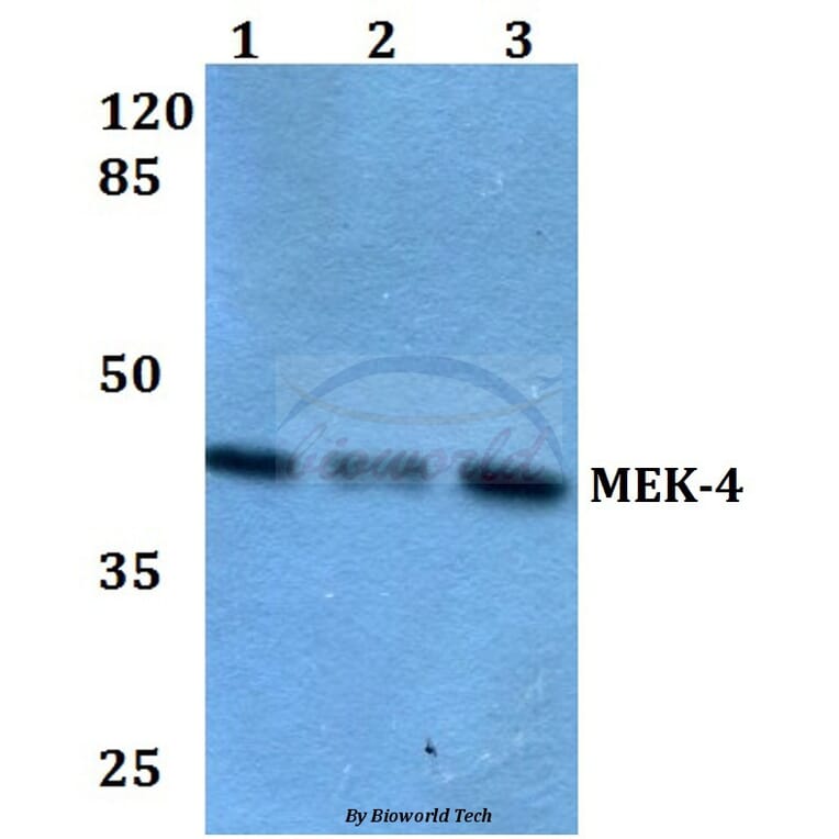 Anti-MEK-4 (Q253) Antibody from Bioworld Technology (BS1693) - Antibodies.com