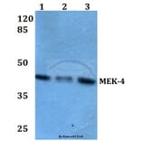 Anti-MEK-4 (Q253) Antibody from Bioworld Technology (BS1693) - Antibodies.com