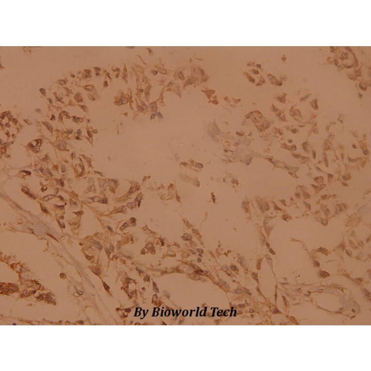 Anti-Skp1 p19 (P72) Antibody from Bioworld Technology (BS1694) - Antibodies.com