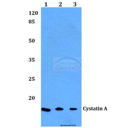 Anti-Cystatin A (G84) Antibody from Bioworld Technology (BS1695) - Antibodies.com