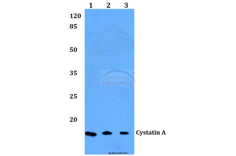 Anti-Cystatin A (G84) Antibody from Bioworld Technology (BS1695) - Antibodies.com