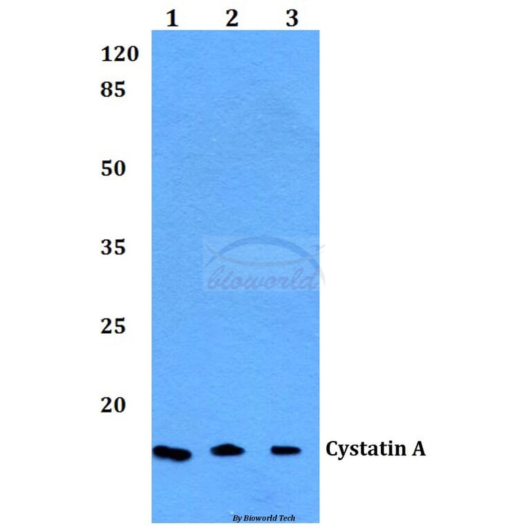 Anti-Cystatin A (G84) Antibody from Bioworld Technology (BS1695) - Antibodies.com