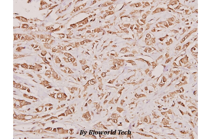 Anti-Cystatin A (G84) Antibody from Bioworld Technology (BS1695) - Antibodies.com
