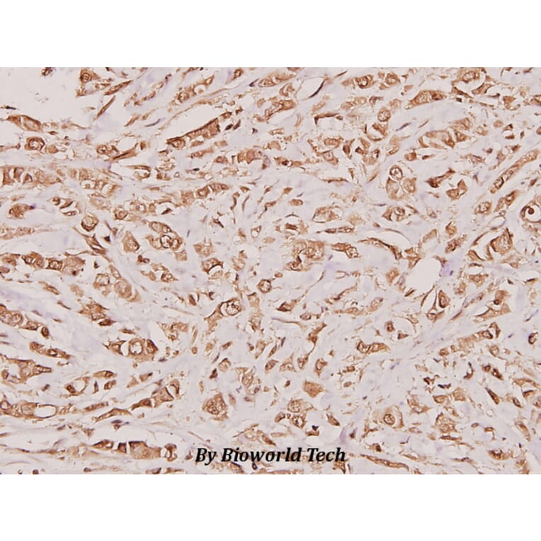 Anti-Cystatin A (G84) Antibody from Bioworld Technology (BS1695) - Antibodies.com