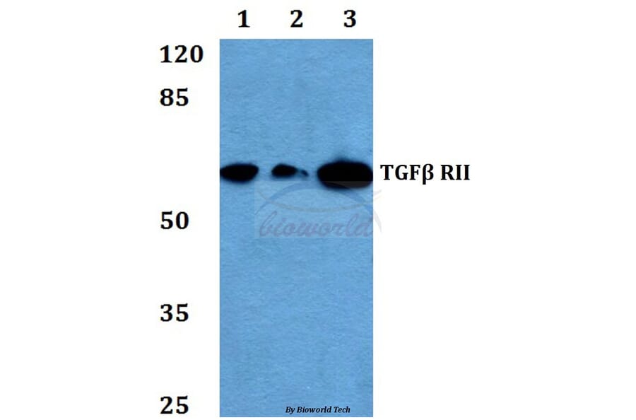 Anti-TGFβ RII (E246) Antibody from Bioworld Technology (BS1696) - Antibodies.com