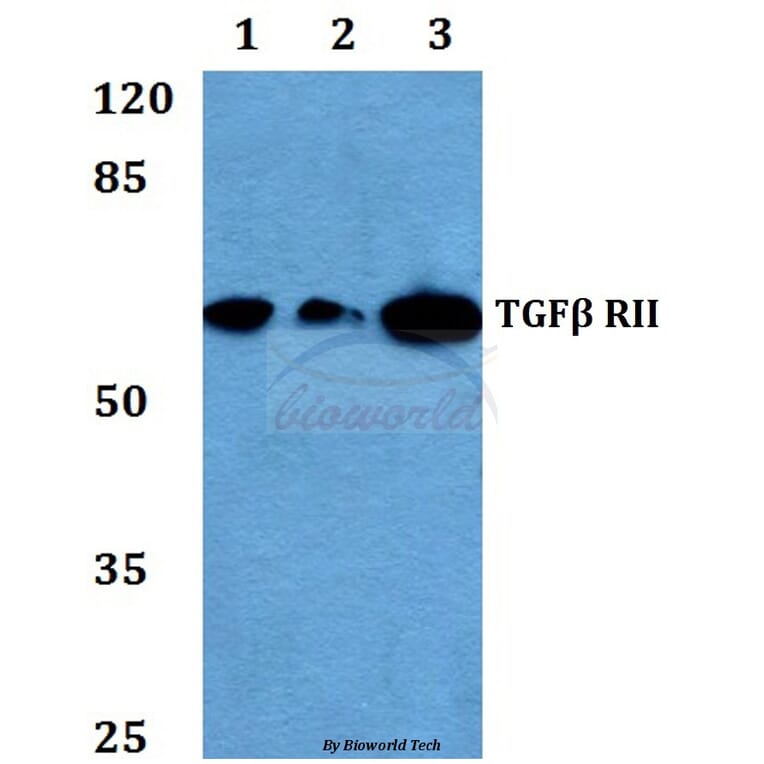 Anti-TGFβ RII (E246) Antibody from Bioworld Technology (BS1696) - Antibodies.com