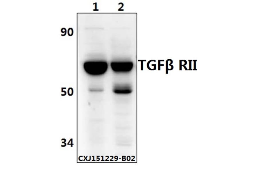 Anti-TGFβ RII (E246) Antibody from Bioworld Technology (BS1696) - Antibodies.com