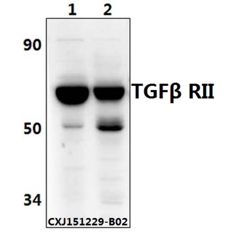 Anti-TGFβ RII (E246) Antibody from Bioworld Technology (BS1696) - Antibodies.com