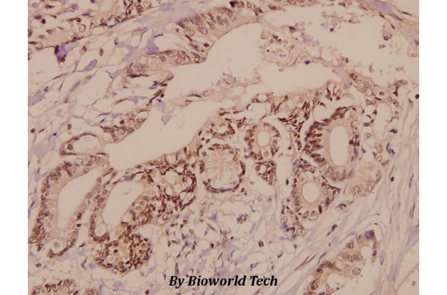 Anti-TGFβ RII (E246) Antibody from Bioworld Technology (BS1696) - Antibodies.com
