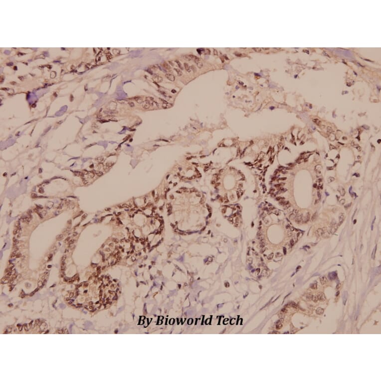 Anti-TGFβ RII (E246) Antibody from Bioworld Technology (BS1696) - Antibodies.com