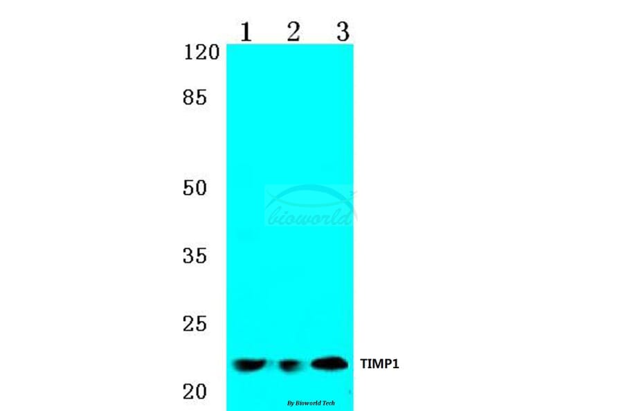 Anti-TIMP-1 (G94) Antibody from Bioworld Technology (BS1697) - Antibodies.com