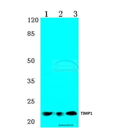 Anti-TIMP-1 (G94) Antibody from Bioworld Technology (BS1697) - Antibodies.com
