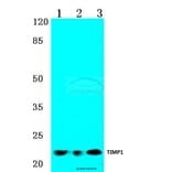 Anti-TIMP-1 (G94) Antibody from Bioworld Technology (BS1697) - Antibodies.com