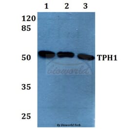 Anti-TPH1 (K54) Antibody from Bioworld Technology (BS1698) - Antibodies.com