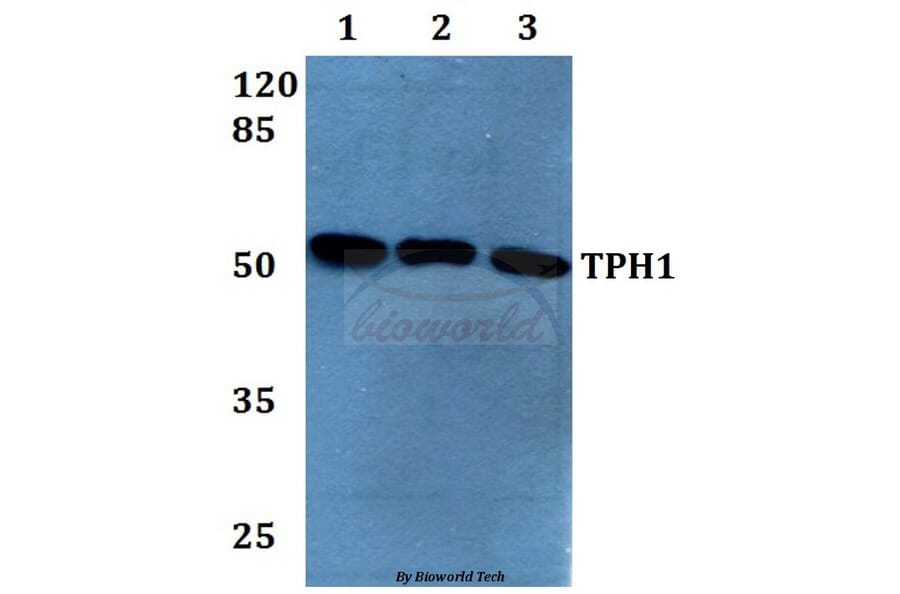 Anti-TPH1 (K54) Antibody from Bioworld Technology (BS1698) - Antibodies.com