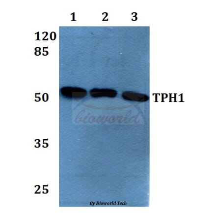 Anti-TPH1 (K54) Antibody from Bioworld Technology (BS1698) - Antibodies.com