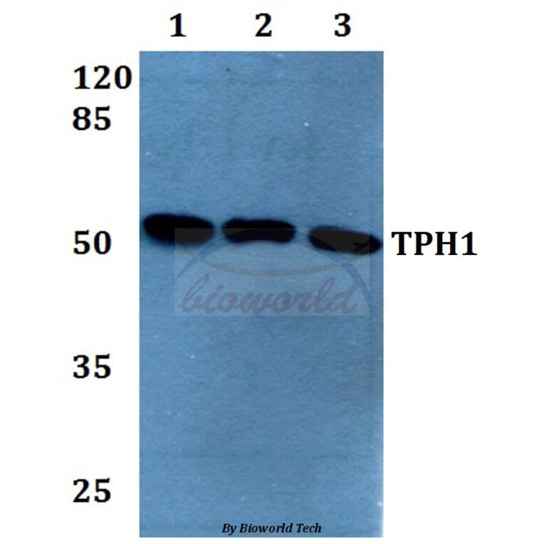 Anti-TPH1 (K54) Antibody from Bioworld Technology (BS1698) - Antibodies.com