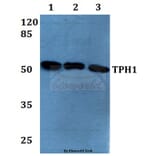Anti-TPH1 (K54) Antibody from Bioworld Technology (BS1698) - Antibodies.com