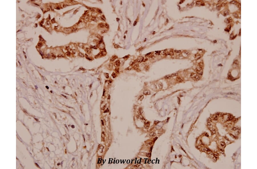 Anti-TPH1 (K54) Antibody from Bioworld Technology (BS1698) - Antibodies.com