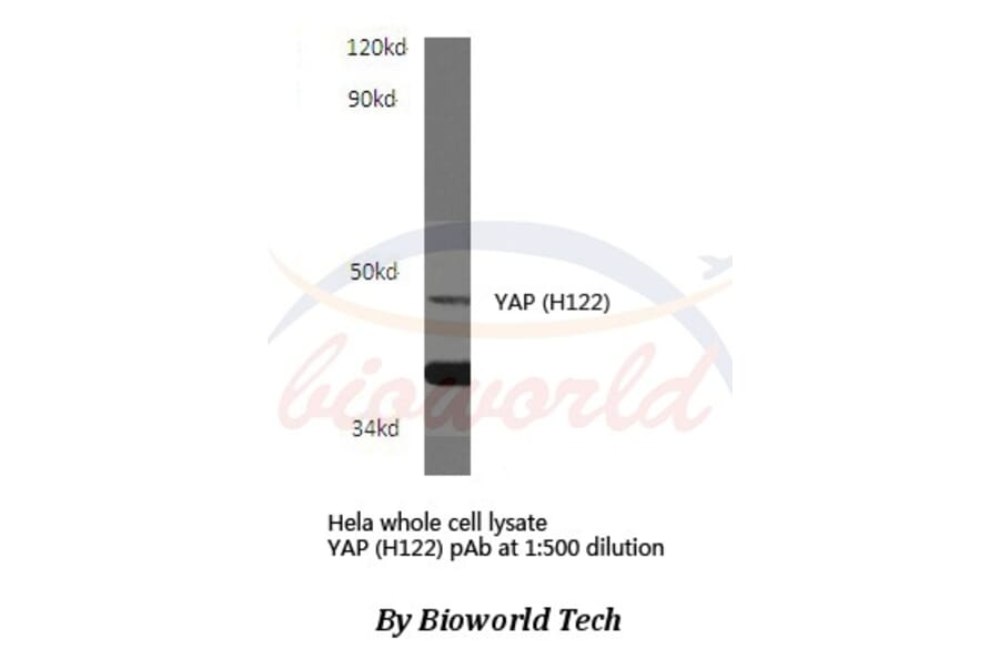 Anti-YAP (H122) Antibody from Bioworld Technology (BS1701) - Antibodies.com
