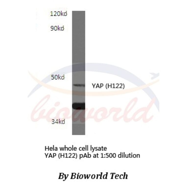Anti-YAP (H122) Antibody from Bioworld Technology (BS1701) - Antibodies.com