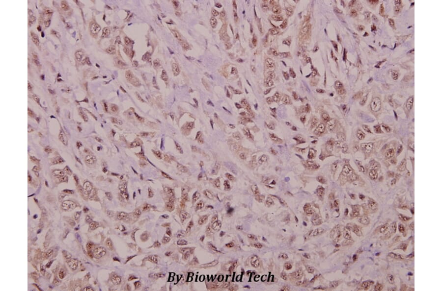 Anti-YAP (H122) Antibody from Bioworld Technology (BS1701) - Antibodies.com