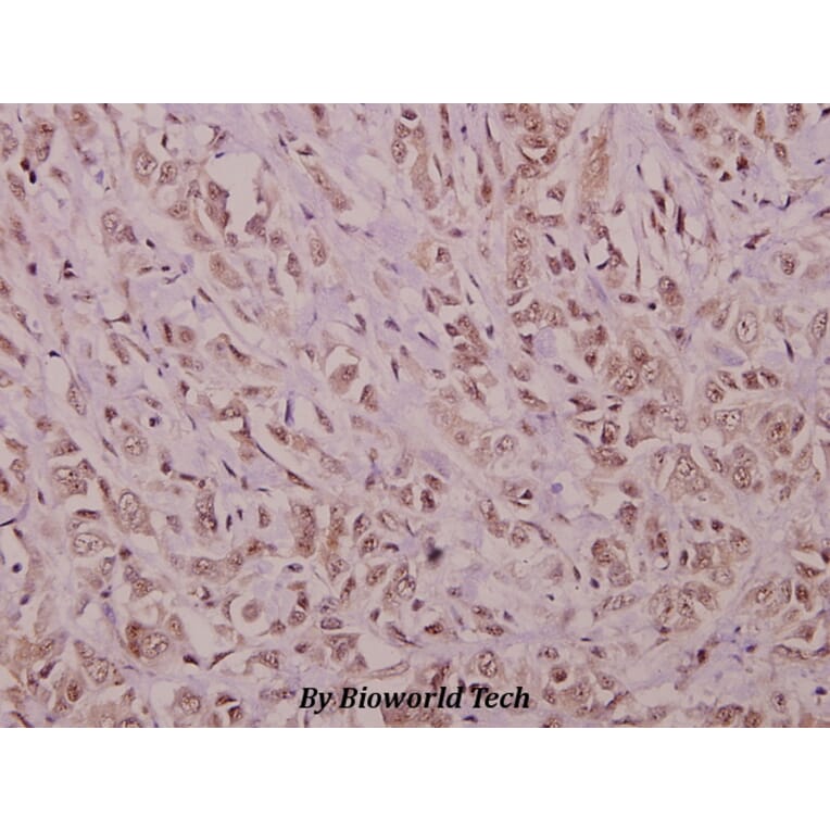 Anti-YAP (H122) Antibody from Bioworld Technology (BS1701) - Antibodies.com