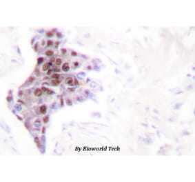 Anti-ATP8 Antibody from Bioworld Technology (BS1702) - Antibodies.com