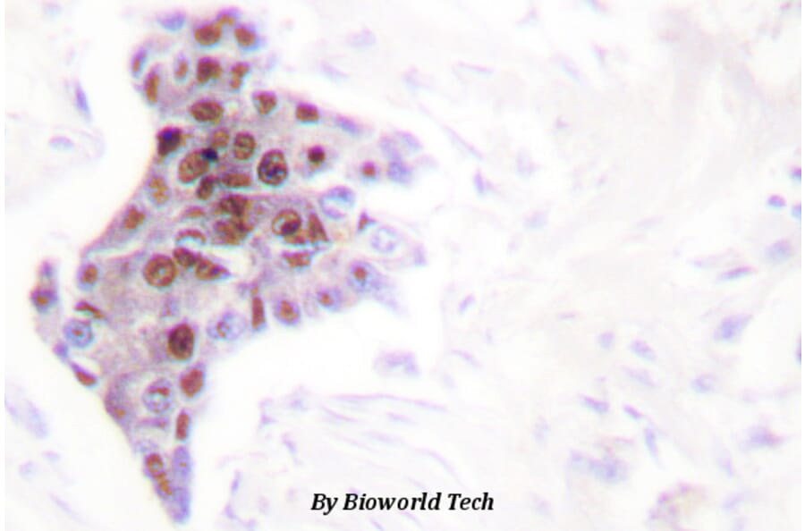 Anti-ATP8 Antibody from Bioworld Technology (BS1702) - Antibodies.com