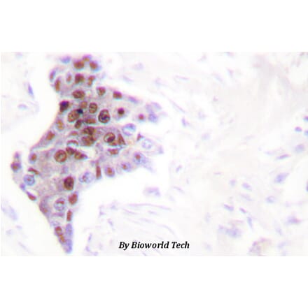 Anti-ATP8 Antibody from Bioworld Technology (BS1702) - Antibodies.com