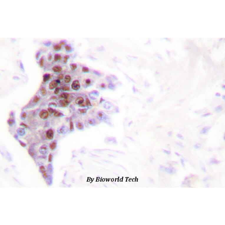 Anti-ATP8 Antibody from Bioworld Technology (BS1702) - Antibodies.com