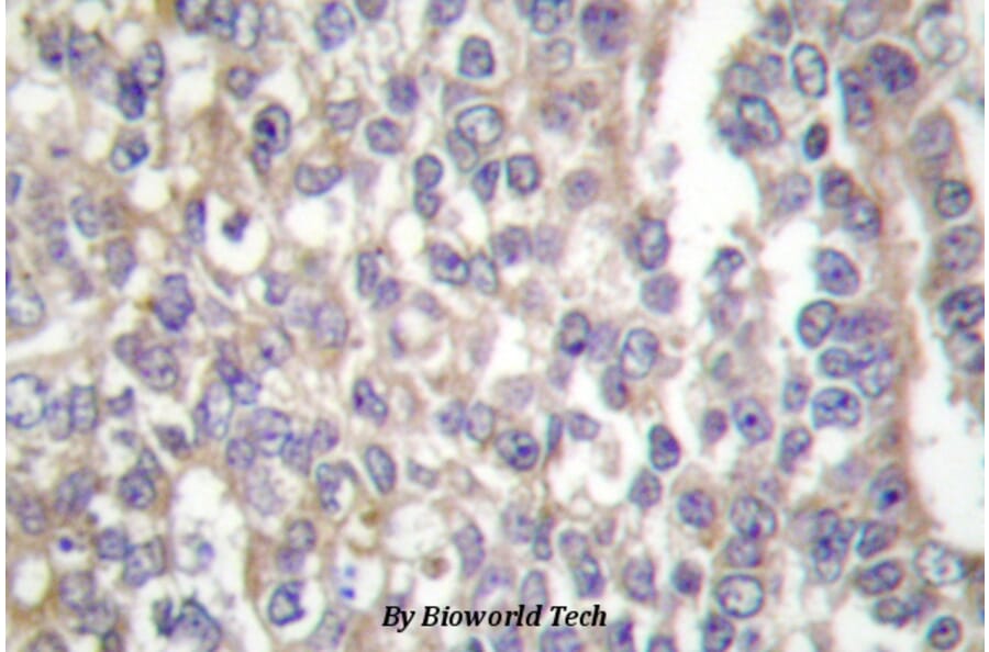 Anti-Shc (E343) Antibody from Bioworld Technology (BS1704) - Antibodies.com