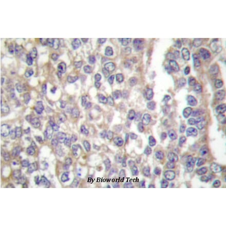 Anti-Shc (E343) Antibody from Bioworld Technology (BS1704) - Antibodies.com