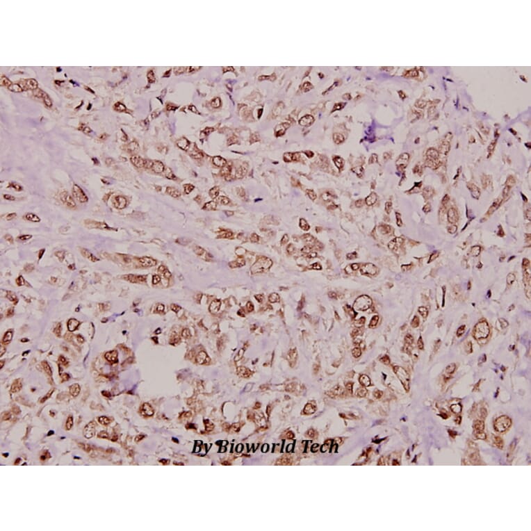 Anti-CrkL (P201) Antibody from Bioworld Technology (BS1706) - Antibodies.com