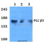 Anti-PLC β3 (D1099) Antibody from Bioworld Technology (BS1708) - Antibodies.com