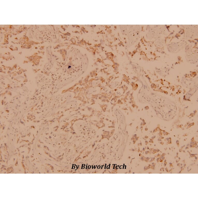 Anti-PLC γ1 (G765) Antibody from Bioworld Technology (BS1709) - Antibodies.com