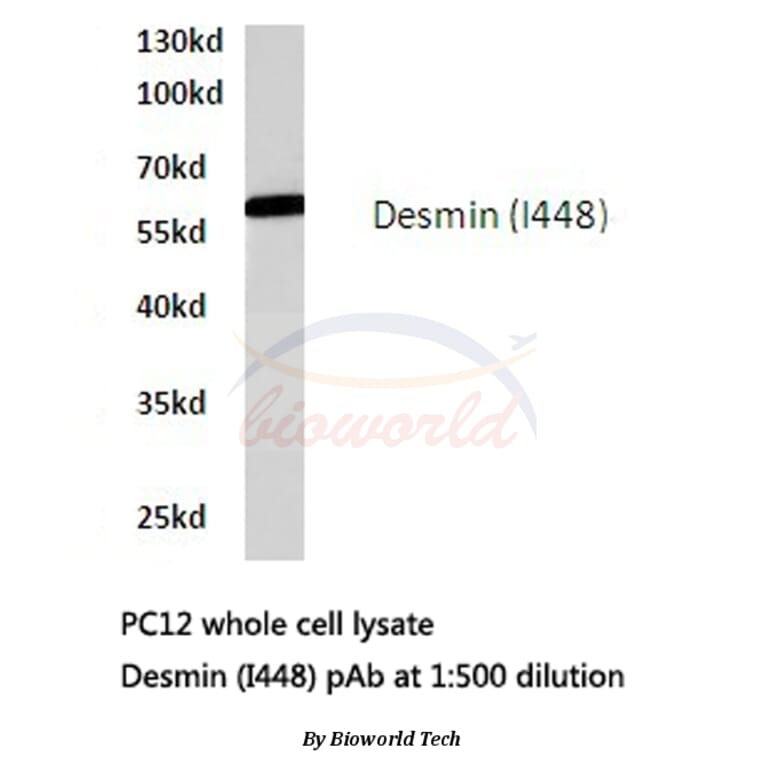 Anti-Desmin (I448) Antibody from Bioworld Technology (BS1712) - Antibodies.com
