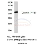 Anti-Desmin (I448) Antibody from Bioworld Technology (BS1712) - Antibodies.com