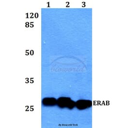 Anti-ERAB (E135) Antibody from Bioworld Technology (BS1713) - Antibodies.com
