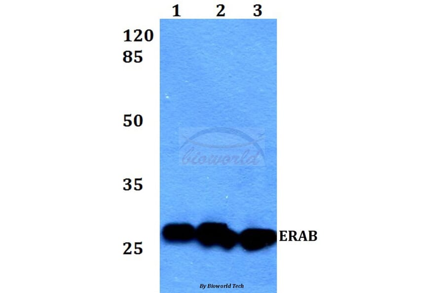 Anti-ERAB (E135) Antibody from Bioworld Technology (BS1713) - Antibodies.com