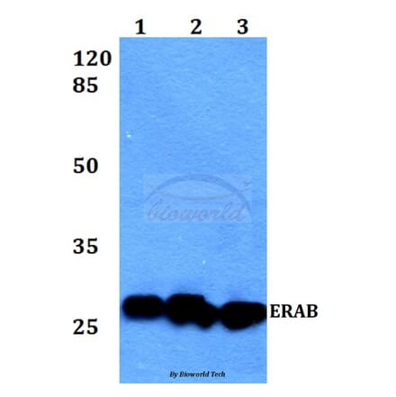 Anti-ERAB (E135) Antibody from Bioworld Technology (BS1713) - Antibodies.com